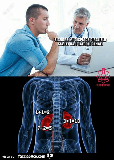Signore mi dispiace dirglielo ma lei ha i calcoli renali